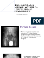 Perbedaan Gambaran Radiologis Dari Avn, Ddh,