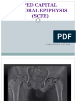 Understanding Slipped Capital Femoral Epiphysis (SCFE