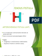 29) Arteriovenous Fistula