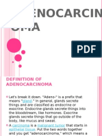 Adenocarcinoma