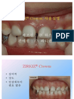 Everything You Need to Know About ZIRKIZ® Dental Crowns