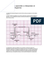 Electrocardiograma