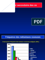 11 - Cancer Secondaire