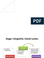 Inflamasi Gingivitis