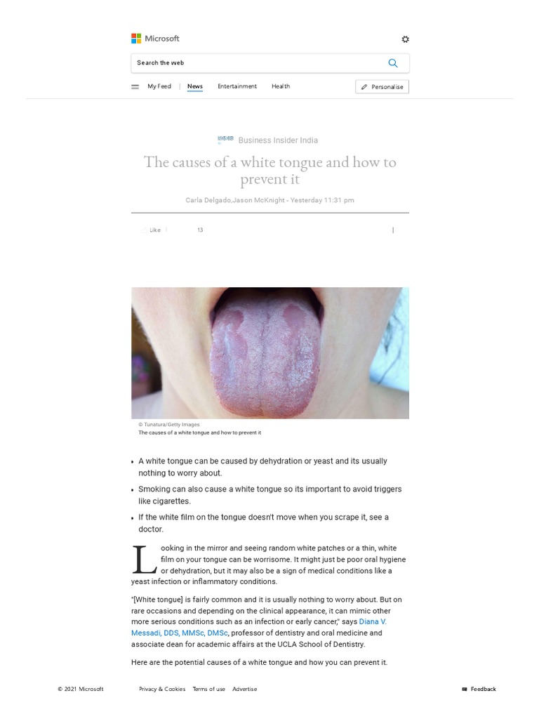 Will a White Tongue Change Everything About Your Health?