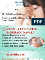 La Epistaxis