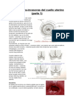 Lesiones Pre-Invasoras Del Cuello Uterino (Parte 1)