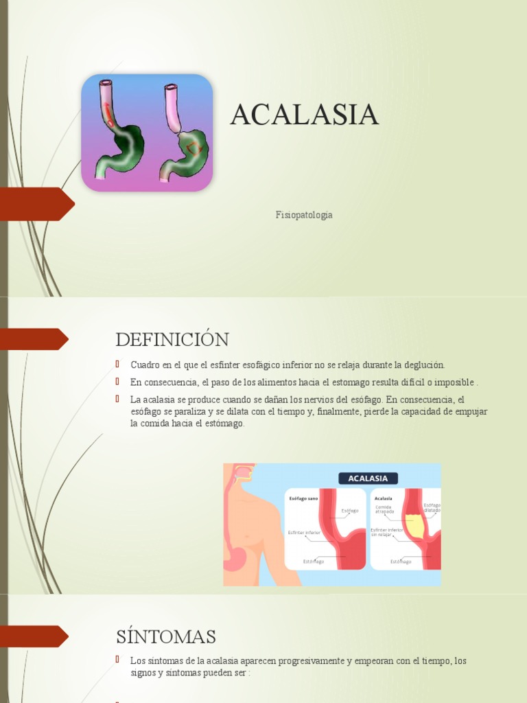 ACALASIA | PDF