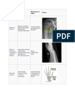 List of Fracture