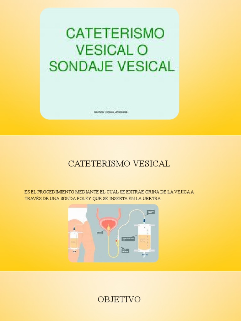 Procedimiento de Cateterismo Vesical | PDF | Vejiga urinaria | Anatomía ...
