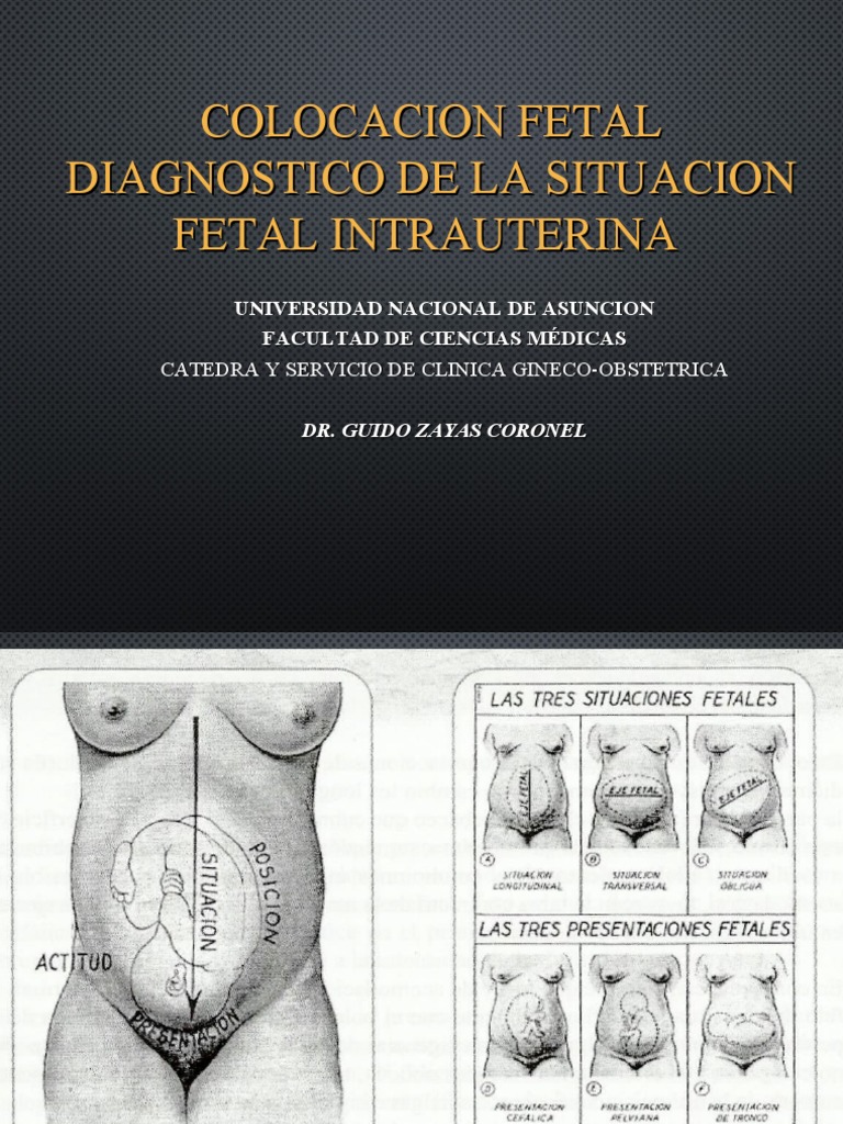 Colocacion Fetal Diagnostico De La Situacion Fetal Intrauterina PDF