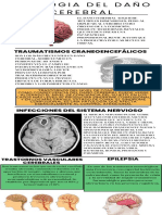 Causas del daño cerebral: traumatismos, infecciones, problemas vasculares y epilepsia