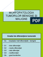 MORFOPATOLOGIA TUMORILOR BENIGNE ªI MALIGNE.ppt