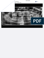 RX Maxilofacial Jonathan García PDF