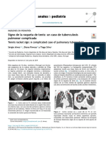 Anemia Ferropénica II