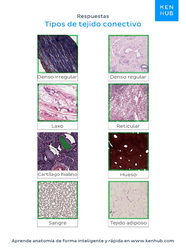 worksheetconnectivetissueanswersspanish (1) PDF