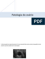 Patologia Ovário e Tuba 2-2022 PDF