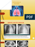 Patologias Pulmonares