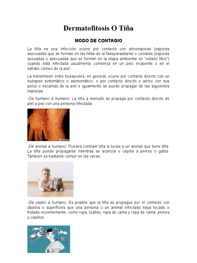 Tiña | PDF | Corticosteroides | Enfermedades y trastornos