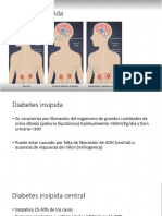 Diabetes Insipida y SIADH