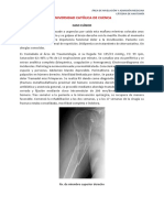 Caso Clínico Húmero PDF