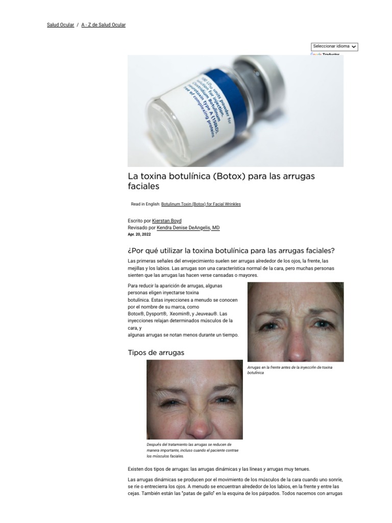 La Toxina Botulínica (Botox) para Las Arrugas Faciales - American ...