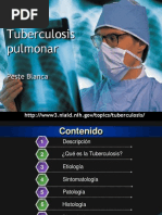 Tuberculosis pulmonar
