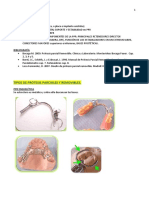 Principales componentes y diseño de prótesis parcial removible