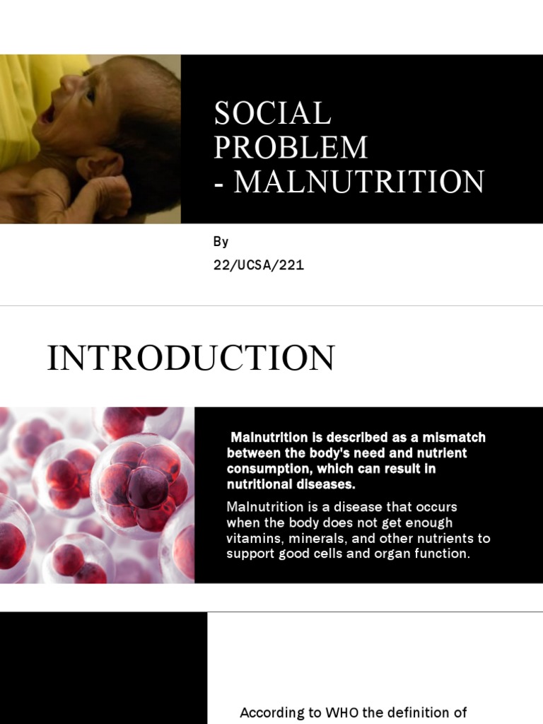 Malnutrition Pdf Malnutrition Nutrients