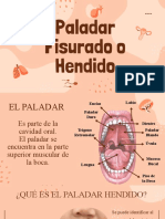 Paladar Hendido