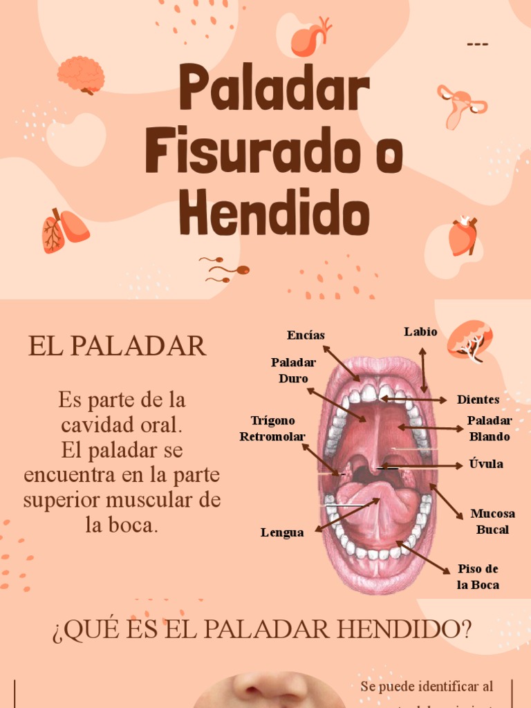 Paladar Hendido: Causas y Tratamiento | PDF | Boca | El embarazo