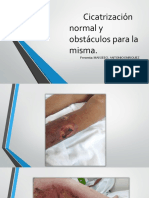 Cicatrizacion PDF
