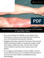 Cellulitis Causes, Symptoms and Treatment at Safe Health Center in MT Pleasant, MI