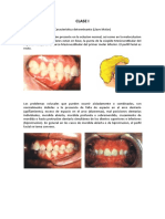 Llaves de La Oclusion. Pag 100-112