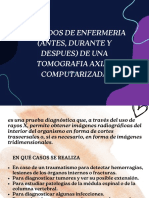 Cuidados de Enfermeria (Antes, Durante y Despues) de Una Tomografia Axial Computarizada PDF