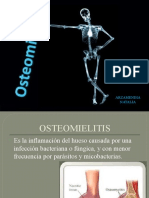 OSTEOMIELITIS