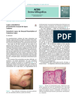 Cartas Científico-Clínicas: Lupus Comedónico: Presentación Inusual de Lupus Cutáneo