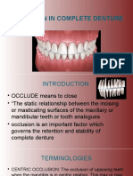 Occlusion in Complete Denture