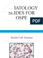 OSPE (Hematology)