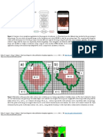 Melanoma Detection Smartphone Application