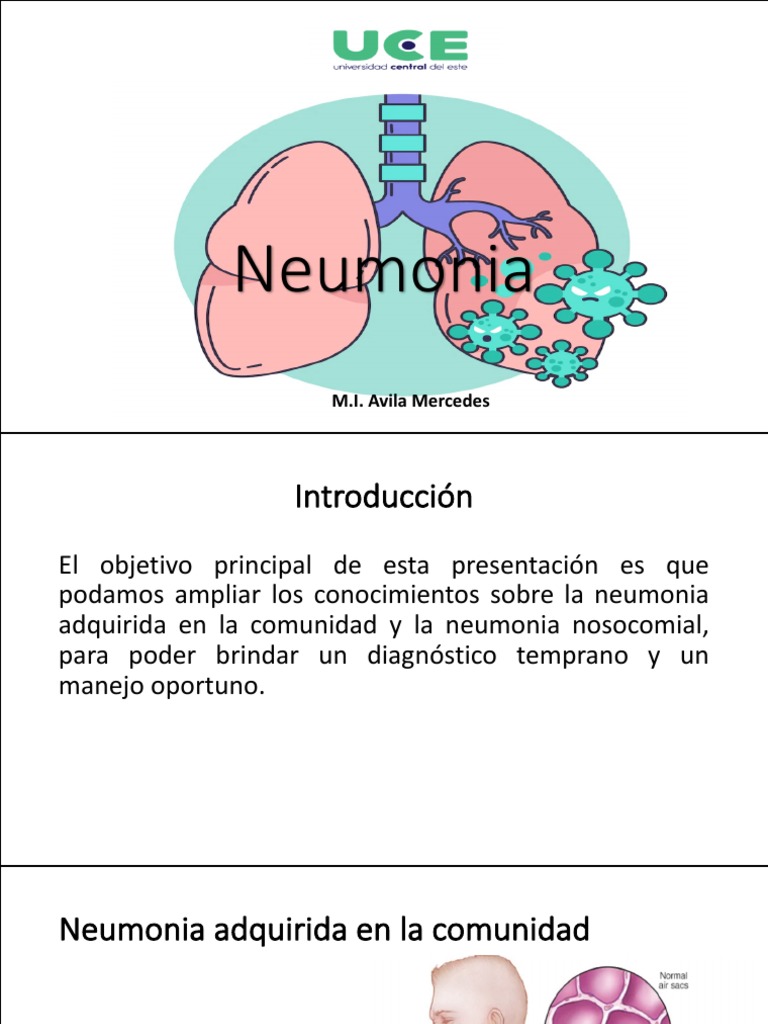 Neumonía: Diagnóstico y Manejo | PDF