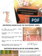 Atrofia Muscular de Duchenne