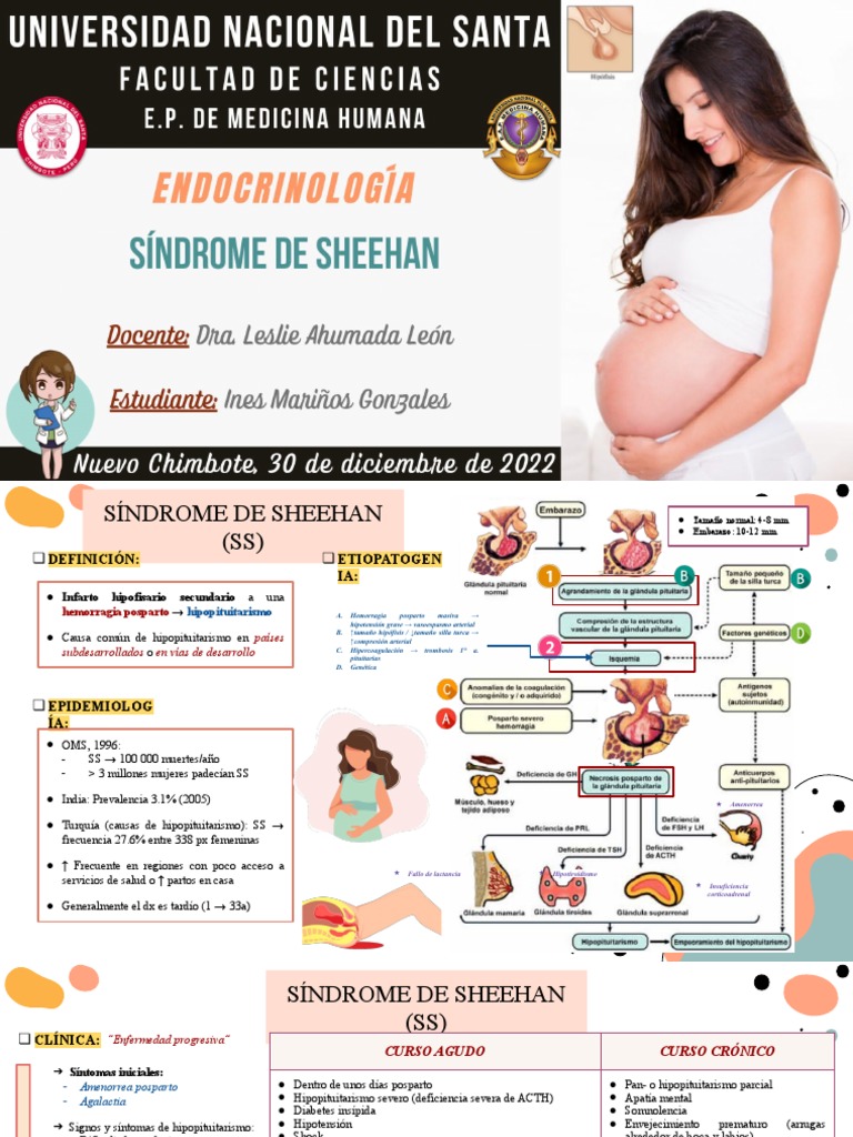 Síndrome de Sheehan | PDF