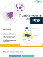 Trombocitopenia Pauli