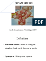 Classification FIGO Des Fibromes Utérins - Embolisation Fibrome Utérin ...