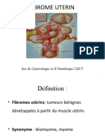 FIBROME UTERIN.pptx