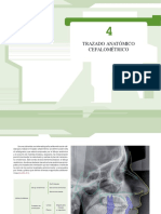 localización de estructuras