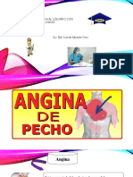 TEMA05 Angina de Pecho