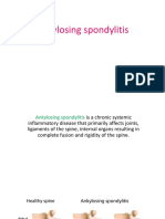 Seronegative Spondyloarthropathies