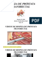 Biopsia de Próstata Transrectal